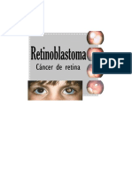 Retinoblastoma PDF