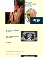 Anatomía de las pleuras y cavidades pulmonares