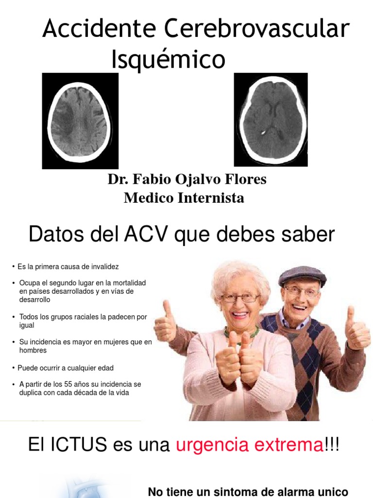 ACV Isquemico PDF | PDF