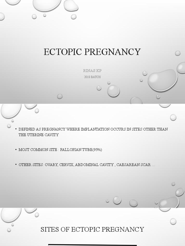 Ectopic Pregnancy-1 | PDF