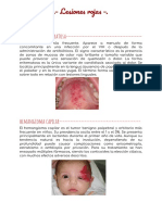 Lesiones Rojas PDF