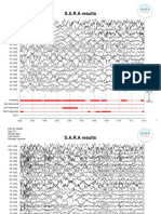 SARA EC Laplacian PDF