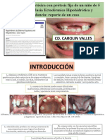 REHABILITACION Oral Protesis Fija