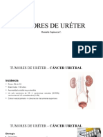 Tumores de Uréter