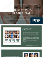 Microsomia Hemifacial