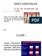 Recesiones Gingivales