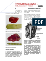 Paratiroidectomía 1 PDF