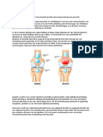 Bursitis