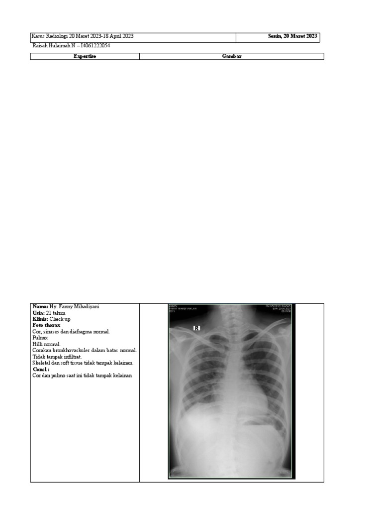 Hasil Radiologi: Normalitas Organ | PDF