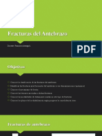 18 - Fracturas Del Antebrazo - 054528
