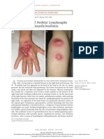 Esporotricosis Con Linfangitis Nejm PDF