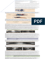 Síndrome de La Vena Cava Superior Diagnóstico y Tratamiento PDF