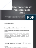 Interpretación de La Radiografía de Tórax PDF