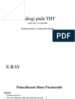 Radiogi Pada THT: X-Ray, Usg, CT Scan, Mri Madeleine Nadya W. Senduk/18014101060