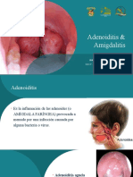 Adenoiditis y Amigdalitis