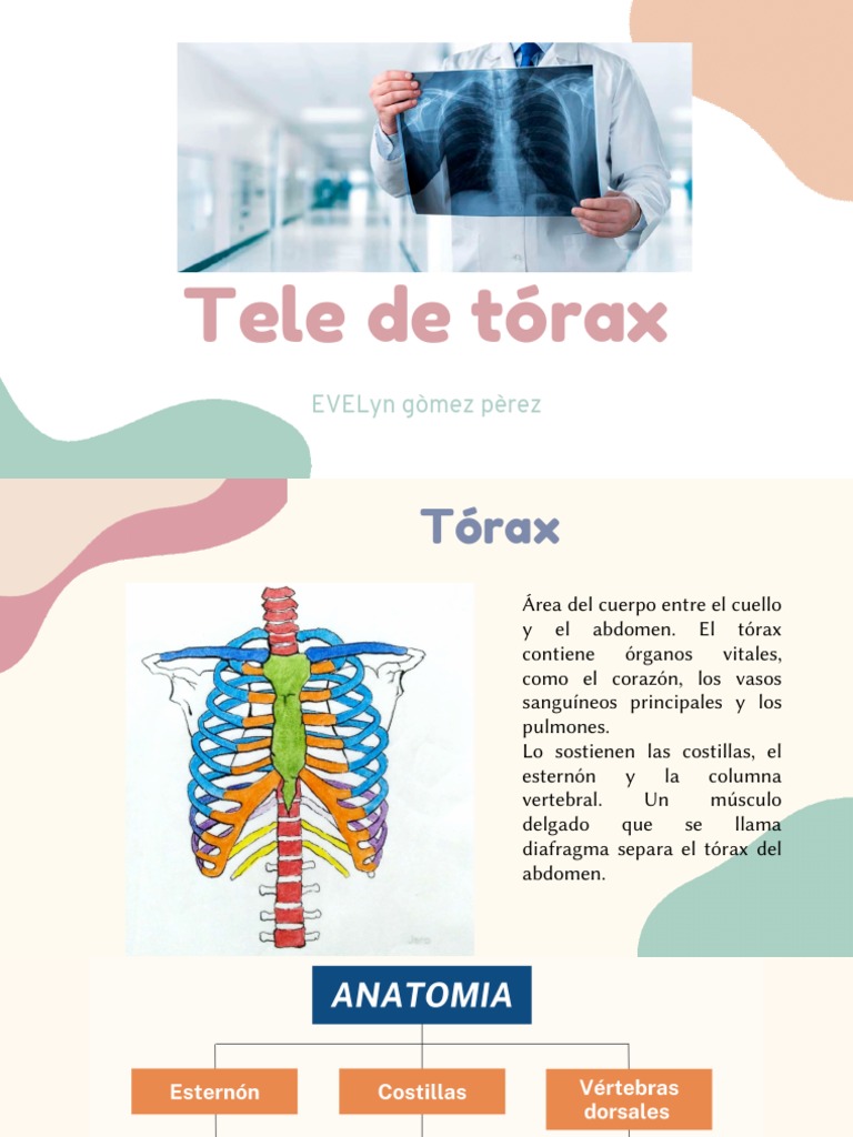 Tele de Tórax | PDF | Pulmón | Tórax