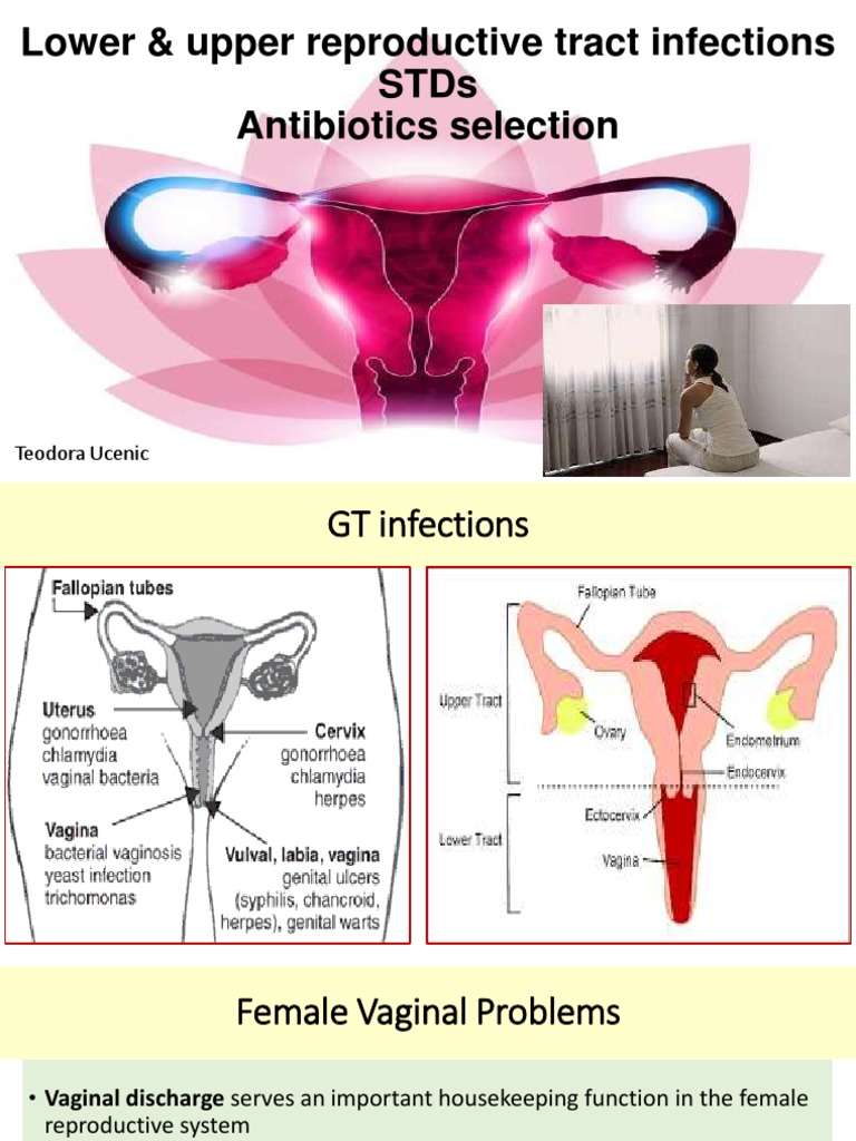 Understanding Reproductive Tract Infections | PDF