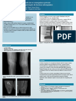 Osteoporose RX