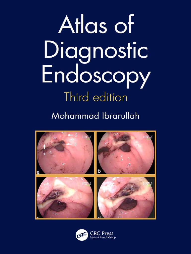 Atlas of Diagnostic Endoscopy, 3rd Ed PDF PDF
