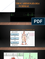 Electrocardiograma Normal