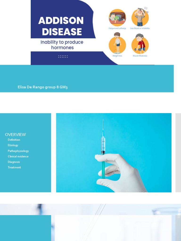 Understanding Addison Disease Causes, Symptoms, Diagnosis and Lifelong