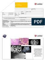 Pla Cancer de Pancreas PDF