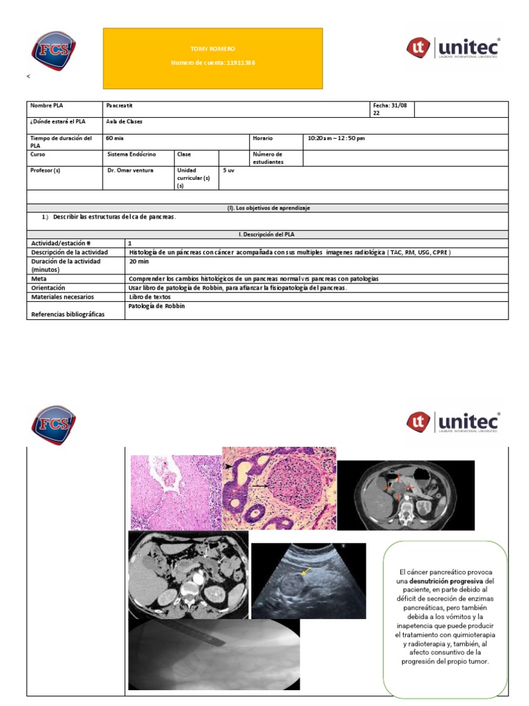 Pla Cancer de Pancreas PDF | PDF