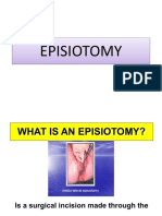 Episiotomy PDF