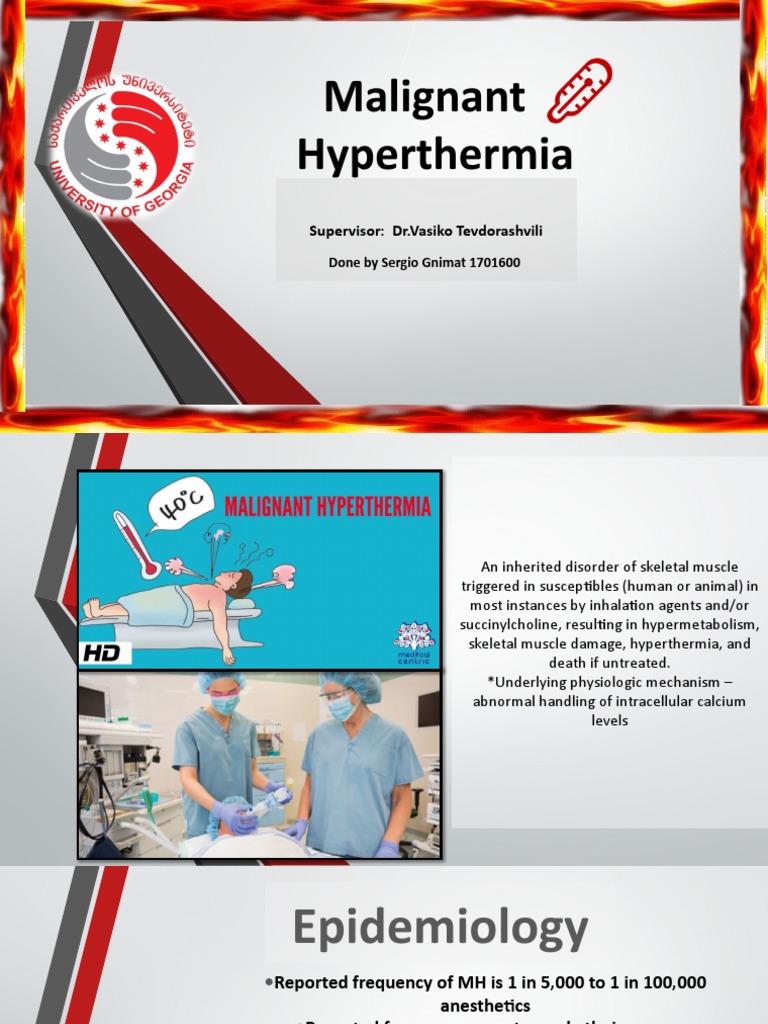 Malignant Hyperthermia Overview | PDF