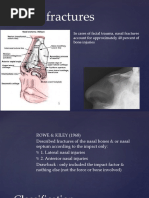 Nasal Fractures