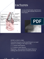 Nasal Fractures