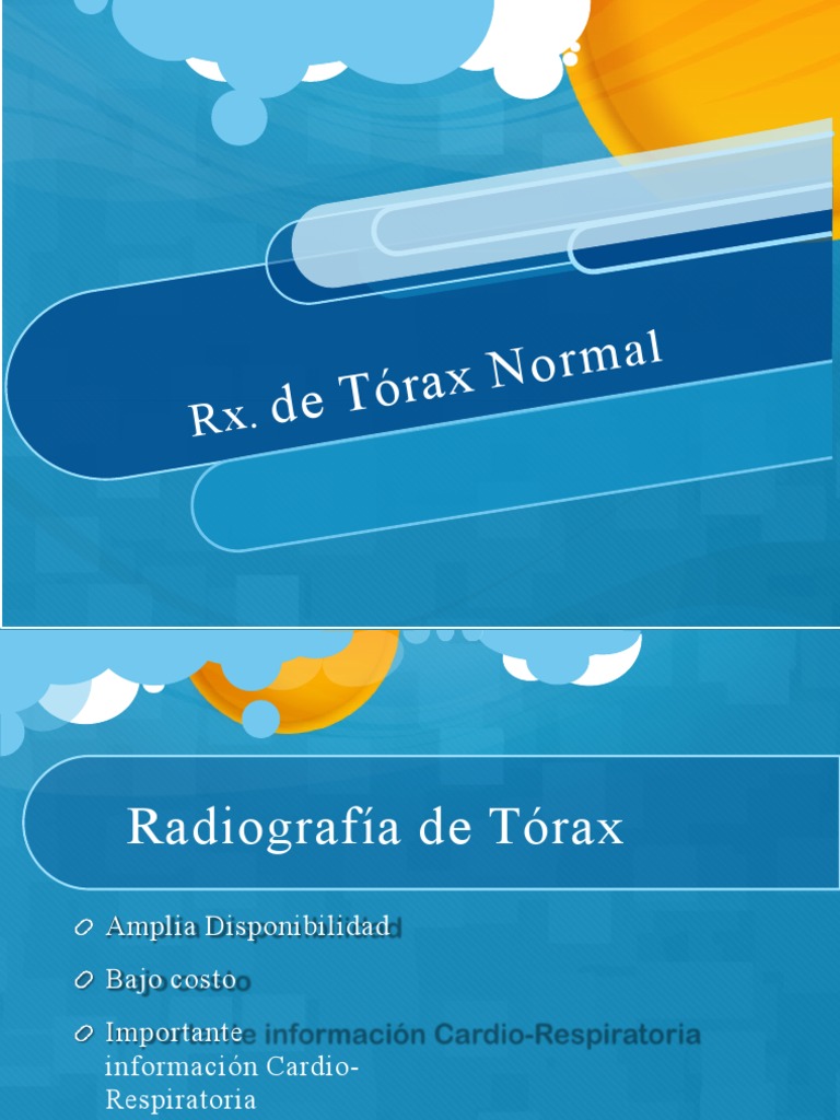 Interpretación de Radiografías de Tórax | PDF