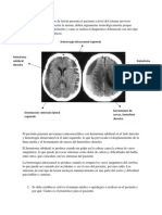 Fase 1 - Caso Clinico