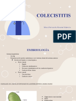 COLECISTITIS