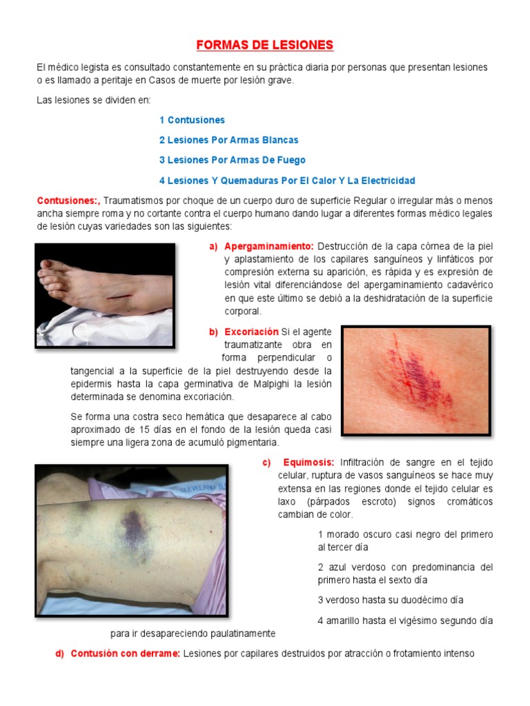 FORMAS DE LESIONES | PDF | Lesión | Anatomía