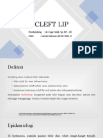 Cleft Lip