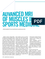 Advanced Mri of Muscles in Sports Medicine