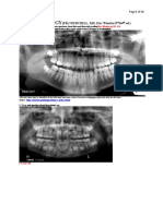 Radiology Review: Key Concepts for Dental Radiographs