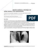 Imagenes Neumonologia Capacidad de Adaptacion Anatomica y Fisiologica Del Cuerpo Humano A Una Neumonectomia PDF