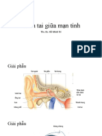 Viêm Tai Gi-A M-N Tính