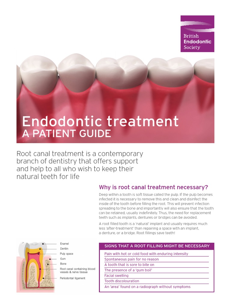 Endodontic Treatment A PATIENT GUIDE PDF