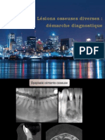 Lesions Osseuses PDF