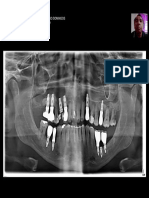 562_jose_levi_machado_domingos_panoramica.pdf