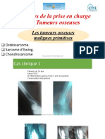 Tumeurs Osseuses 5 - Les TO Malignes Primitives PDF