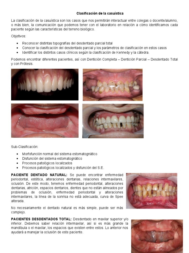Clasificación de La Casuística (28.08.18) | PDF | Dentadura postiza ...