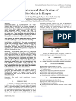 Comparison and Identification of Bite Marks in Kanpur