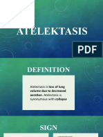 Atelektasis