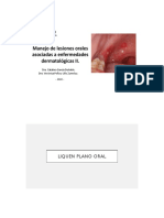 Manejo de lesiones orales asociadas a lupus eritematoso