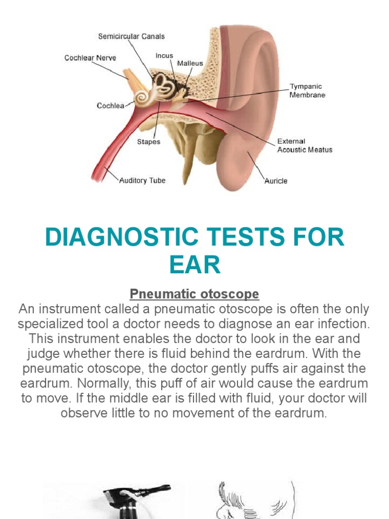ENT Diagnostic Tests Overview | PDF | Electromyography | Allergy