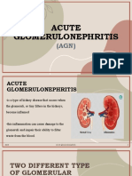 Acute Glomerulonephritis